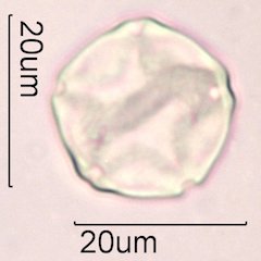 Alder Pollen under the Microscope