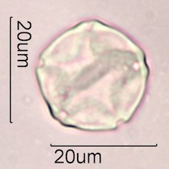 Alder Pollen under the Microscope
