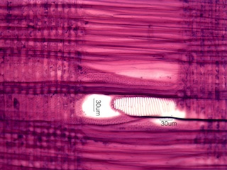 Alnus rubra, Radial-Section