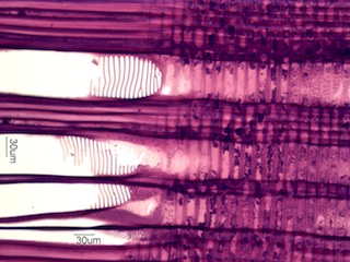 Alnus rubra, Radial-Section