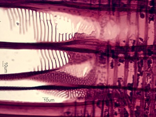 Alnus rubra, Radial-Section