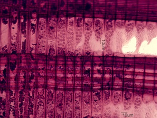 Alnus rubra, Radial-Section