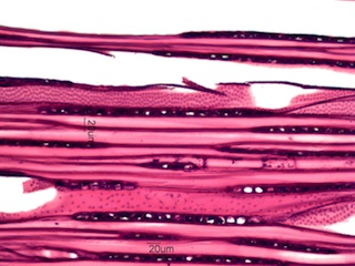 Alnus rubra, Tangential-Section