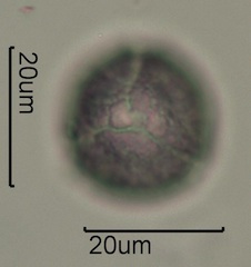 Anemone Pollen under the Microscope