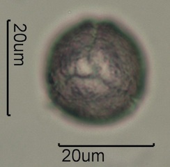 Anemone Pollen under the Microscope
