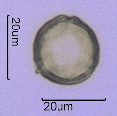 Anemone Pollen under the Microscope