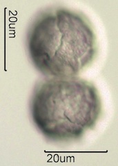 Anemone Pollen under the Microscope