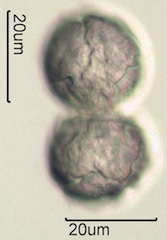 Anemone Pollen under the Microscope