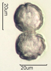 Anemone Pollen under the Microscope