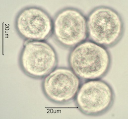 Anemone Pollen under the Microscope
