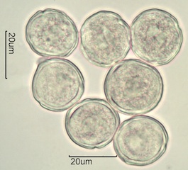 Anemone Pollen under the Microscope
