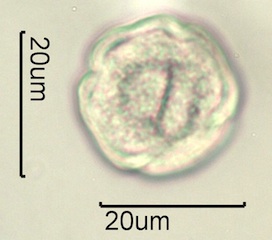 Anemone Pollen under the Microscope