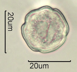 Anemone Pollen under the Microscope