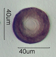 Arcella vulgaris