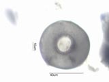 Arcella1a