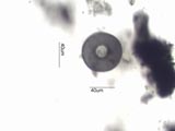 Arcella vulgaris