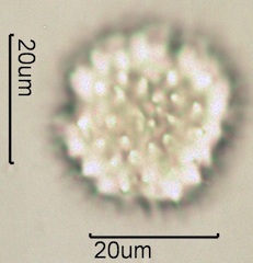 Arnica (Arnica cordifolia) Pollen under the Microscope