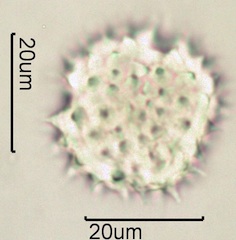 Arnica (Arnica cordifolia) Pollen under the Microscope