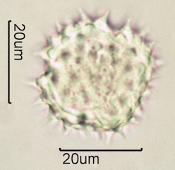 Arnica (Arnica cordifolia) Pollen under the Microscope