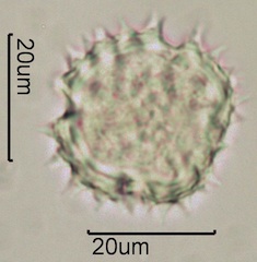 Arnica (Arnica cordifolia) Pollen under the Microscope