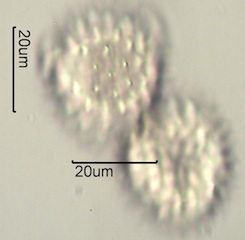 Arnica (Arnica cordifolia) Pollen under the Microscope