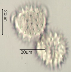 Arnica (Arnica cordifolia) Pollen under the Microscope
