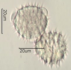 Arnica (Arnica cordifolia) Pollen under the Microscope