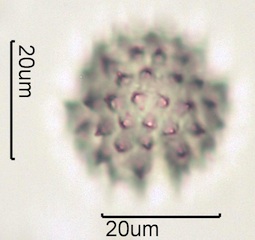 Arnica (Arnica cordifolia) Pollen under the Microscope