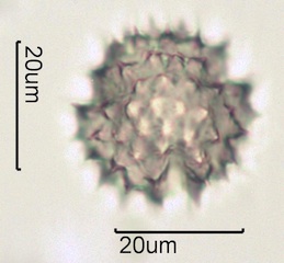 Arnica (Arnica cordifolia) Pollen under the Microscope