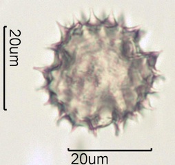 Arnica (Arnica cordifolia) Pollen under the Microscope