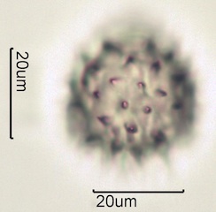 Arnica (Arnica cordifolia) Pollen under the Microscope