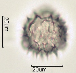 Arnica (Arnica cordifolia) Pollen under the Microscope