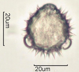 Arnica (Arnica cordifolia) Pollen under the Microscope