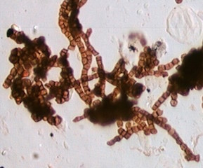 Arthrospores Spores