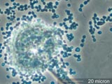 Aspergillus