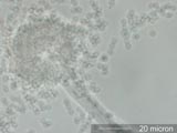 Aspergillus