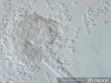 Aspergillus