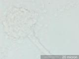 Aspergillus