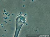 Aspergillus