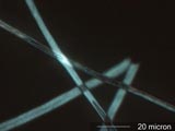 Aspergillus Conidiophore