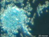 Aspergillus