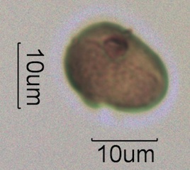 Australian Honey Pollen Under the Microscope
