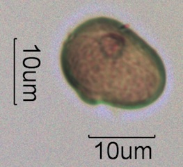 Australian Honey Pollen Under the Microscope