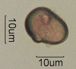 Australian Honey Pollen Under the Microscope