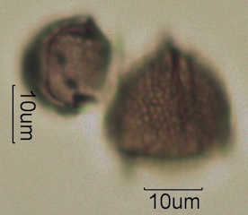Australian Honey Pollen Under the Microscope