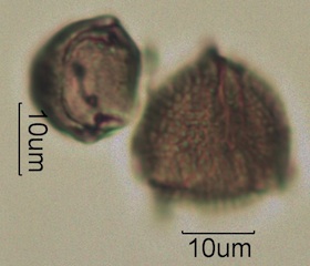 Australian Honey Pollen Under the Microscope