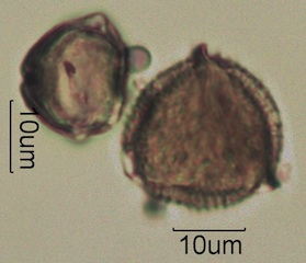 Australian Honey Pollen Under the Microscope
