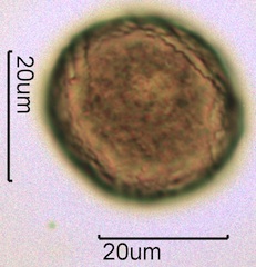 Barberry (Berberis thunbergii) Pollen