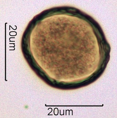 Barberry (Berberis thunbergii) Pollen