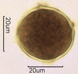 Barberry (Berberis thunbergii) Pollen